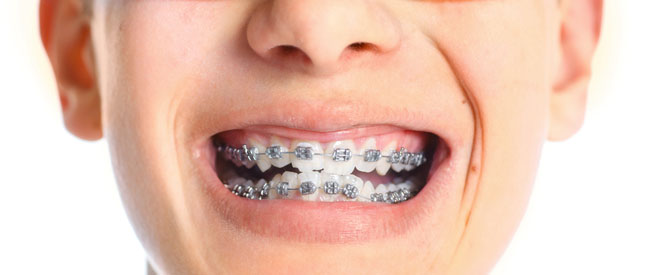 Nhs Care Woodlands Orthodontics 